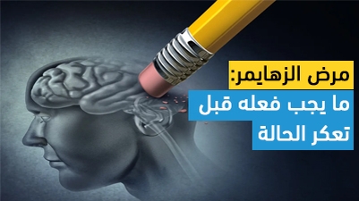 مرض الزهايمر: ما يجب فعله قبل تعكر الحالة