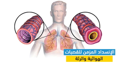 الإنسداد المزمن للقصبات الهوائية والرئة