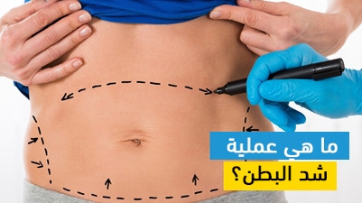ما هي عملية شد البطن؟