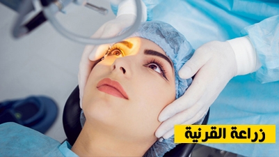 زراعة القرنية