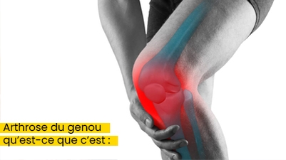 Arthrose du genou qu’est-ce que c’est :