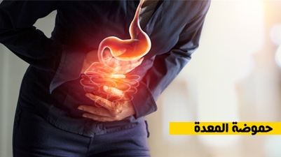 حموضة المعدة