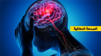 الصدمة الدماغية