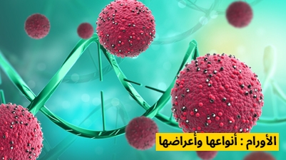 الأورام : أنواعها وأعراضها