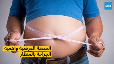 السمنة المرضية وأهمية الجراحة بالمنظار
