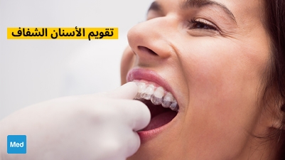 تقويم الأسنان الشفاف