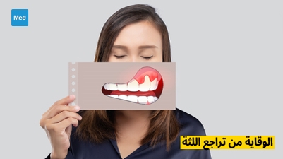 الوقاية من تراجع اللثة: الأسس الأساسية للحفاظ على صحة اللثة والفم