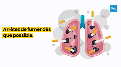 Les dangers du tabagisme et comment arrêter 