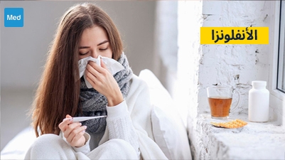 الأنفلونزا