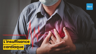 Tout ce que vous devez savoir sur l