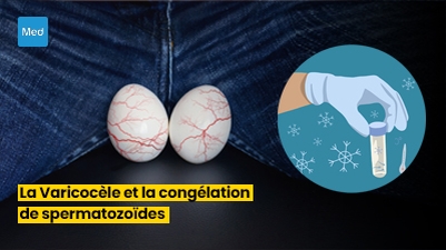 La Varicocèle et la Congélation de Spermatozoïdes : Préservation de la Fertilité avant une Intervention