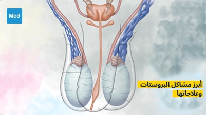 أبرز مشاكل البروستات وعلاجاتها