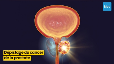 Comprendre le Dépistage du Cancer de la Prostate : Informations Essentielles pour les Hommes