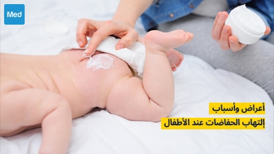 أعراض وأسباب التهاب الحفاظات عند الأطفال