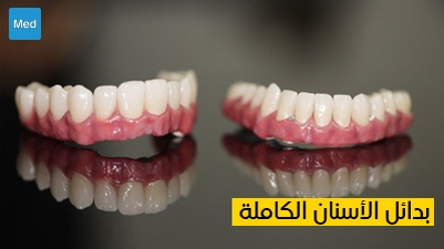 بدائل الأسنان الكاملة