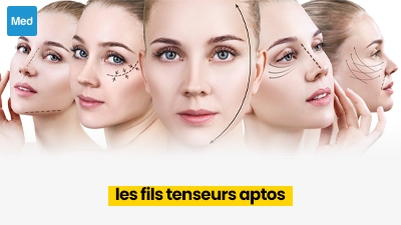 Les fils tenseurs APTOS: un lifting sans chirurgie