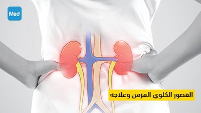 القصور الكلوي المزمن وعلاجه