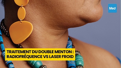 Traitement du Double Menton : Radiofréquence vs Laser Froid