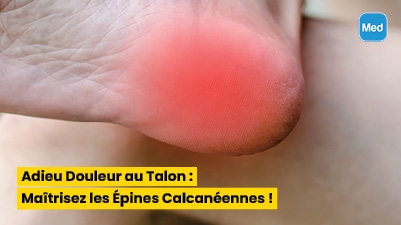 Adieu Douleur au Talon : Maîtrisez les Épines Calcanéennes !