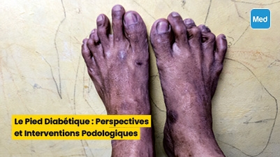 Le Pied Diabétique : Perspectives et Interventions Podologiques