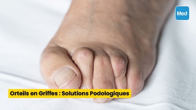 Orteils en Griffes : Solutions Podologiques