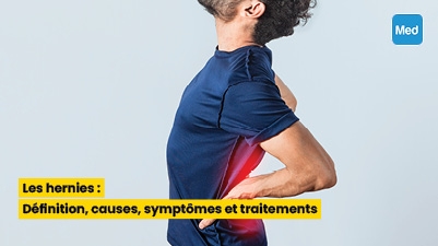 Les hernies : Définition, causes, symptômes et traitements
