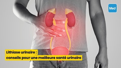 Lithiase urinaire : conseils pour une meilleure santé urinaire