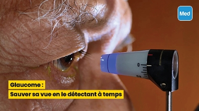 Glaucome : Sauver sa vue en le détectant à temps
