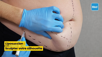 Liposuccion : Sculpter votre silhouette