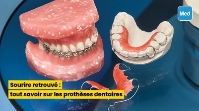 Sourire retrouvé : tout savoir sur les prothèses dentaires