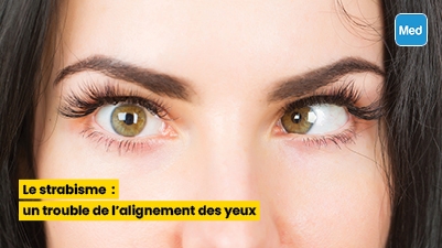Le strabisme : un trouble de l