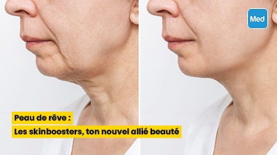Peau de rêve : Les skinboosters, ton nouvel allié beauté