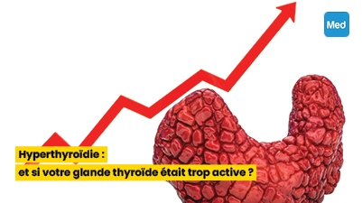 Hyperthyroïdie : et si votre glande thyroïde était trop active ?