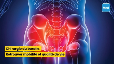 Chirurgie du bassin : Retrouver mobilité et qualité de vie