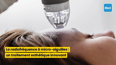 La radiofréquence à micro-aiguilles : un traitement esthétique innovant