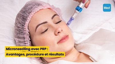 Microneedling avec PRP : Avantages, procédure et résultats