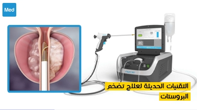 التقنيات الحديثة لعلاج تضخم البروستات
