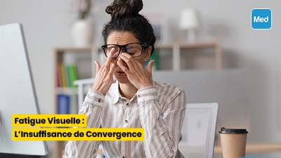 Fatigue Visuelle : L