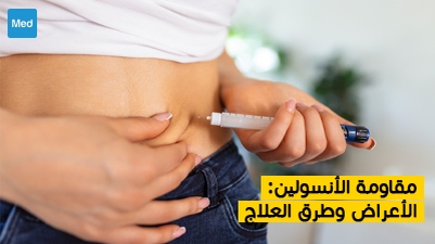 مقاومة الأنسولين : الأعراض وطرق العلاج
