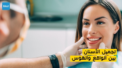 تجميل الأسنان بين الواقع والهوس