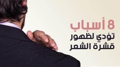 8 أسباب تؤدي لظهور قشرة الشعر 