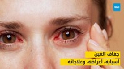 جفاف العين: أسبابه، أعراضه، وعلاجاته