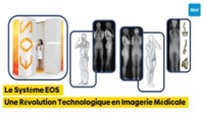 Le Système EOS : Une Révolution Technologique en Imagerie Médicale