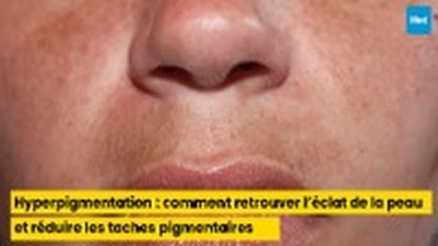 Hyperpigmentation : comment retrouver l’éclat de la peau et réduire les taches pigmentaires