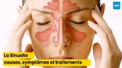 La Sinusite : Comprendre les causes, les symptômes et les traitements modernes