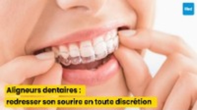 Aligneurs dentaires : redresser son sourire en toute discrétion