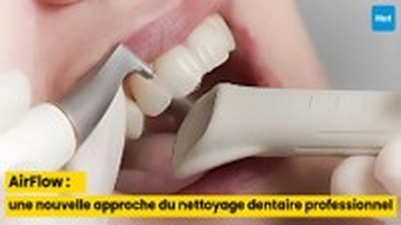 AirFlow ® : une nouvelle approche du nettoyage dentaire professionnel