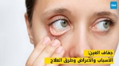 جفاف العين: الأسباب والأعراض وطرق العلاج