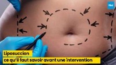 Liposuccion : ce qu’il faut savoir avant une intervention