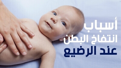 أسباب انتفاخ البطن عند الرضيع